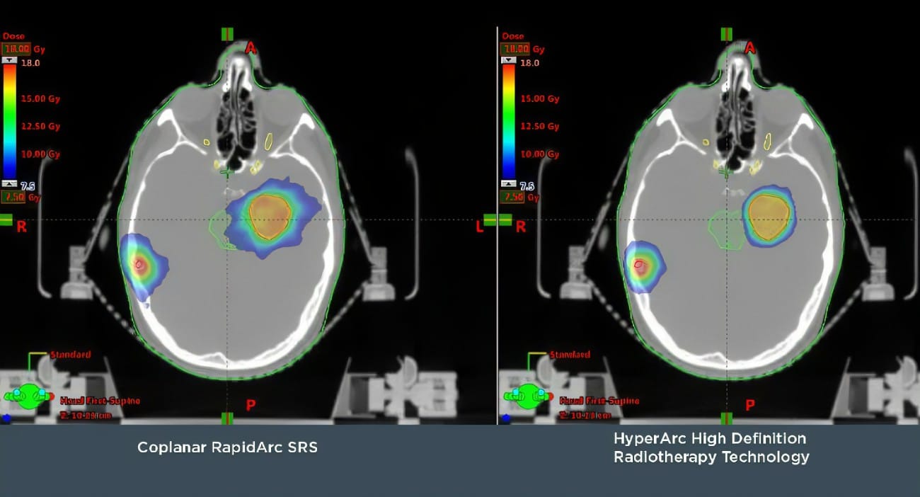 hyperarc_scan, HyperArc